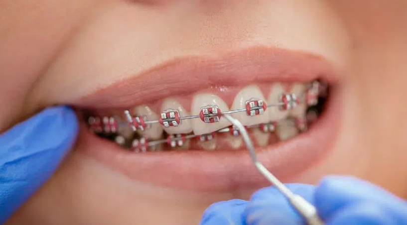 Transform Your Smile: Expert Orthodontics in Forest Hills, NY